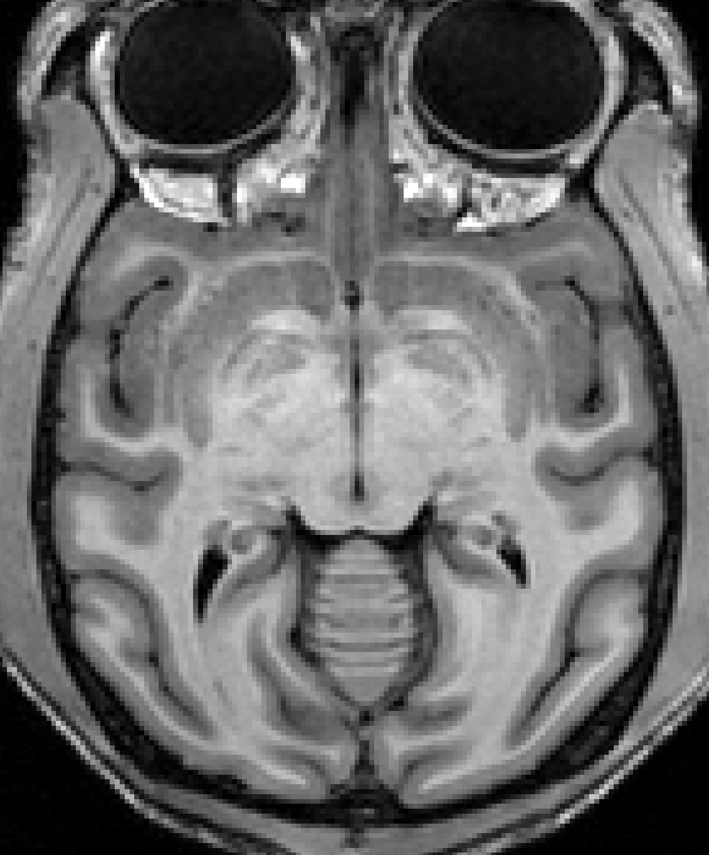 Monkey brain input, single acquisition