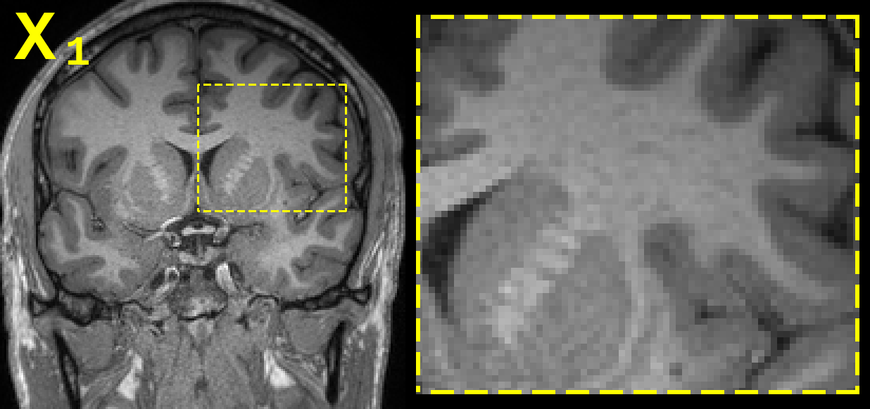 In-session reacquisitions of a routine 0.8mm MPRAGE, showing thermal noise